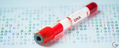 SOYBAĞI NEDİR? NASIL KURULUR?